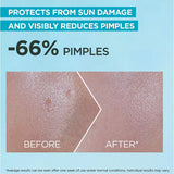 Garnier SkinActive SuperUV Anti-Acne SPF50+ Sunscreen 30 ML