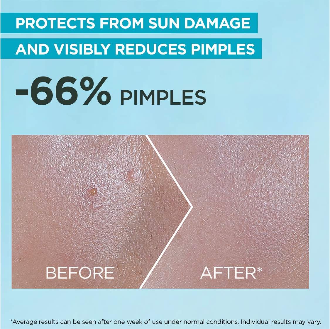 Garnier SkinActive SuperUV Anti-Acne SPF50+ Sunscreen 30 ML